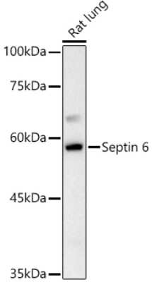 Western Blot: Septin-6 Antibody [NBP3-03686] - Western blot analysis of extracts of Rat lung, using Septin 6 antibody (NBP3-03686) at 1:1000 dilution. Secondary antibody: HRP Goat Anti-Rabbit IgG (H+L) at 1:10000 dilution. Lysates/proteins: 25ug per lane. Blocking buffer: 3% nonfat dry milk in TBST. Detection: ECL Basic Kit. Exposure time: 90s.